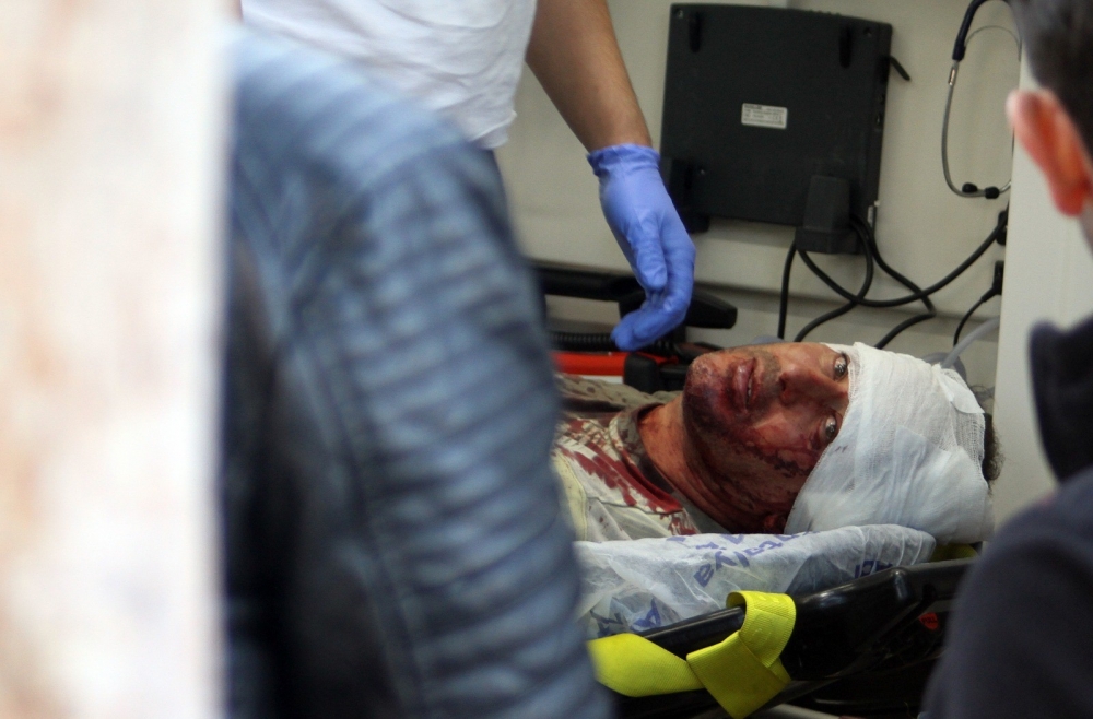 Antalya’da Sopalı, Silahlı Kavga: 3 Yaralı 1