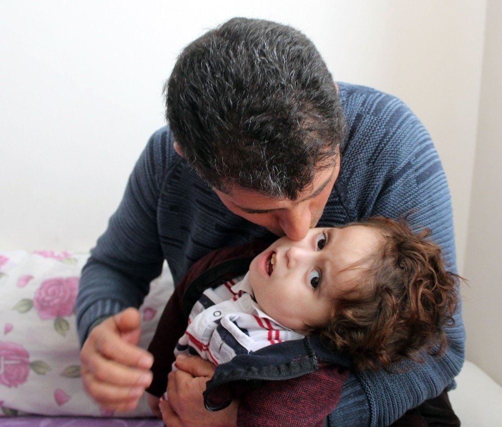 Antalya'da İki Bebeklerini Kaybeden Aile Üçüncü Bebekleri İçin ’Hidrosef 4