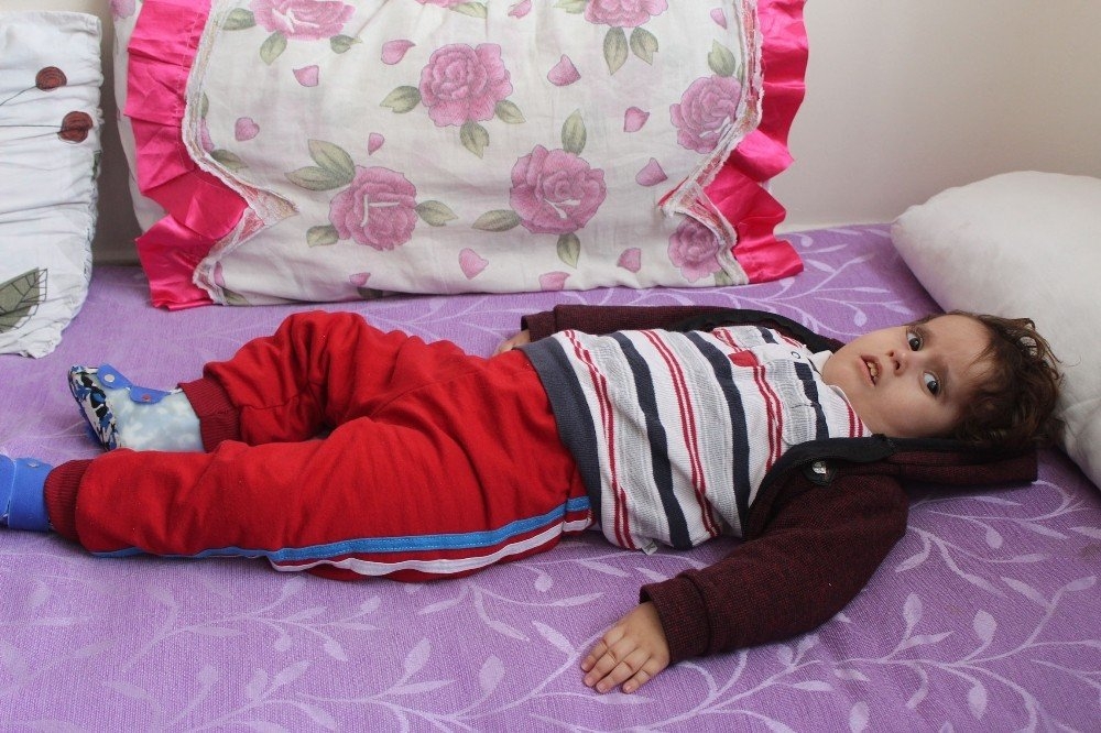 Antalya'da İki Bebeklerini Kaybeden Aile Üçüncü Bebekleri İçin ’Hidrosef 5