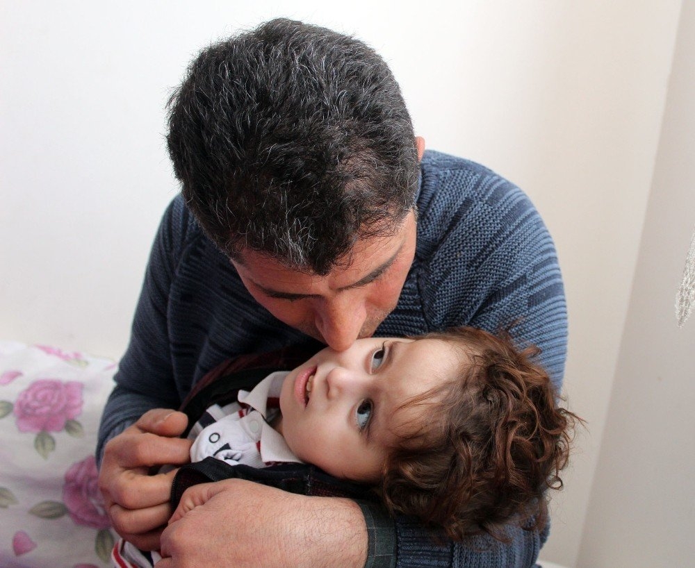 Antalya'da İki Bebeklerini Kaybeden Aile Üçüncü Bebekleri İçin ’Hidrosef 7