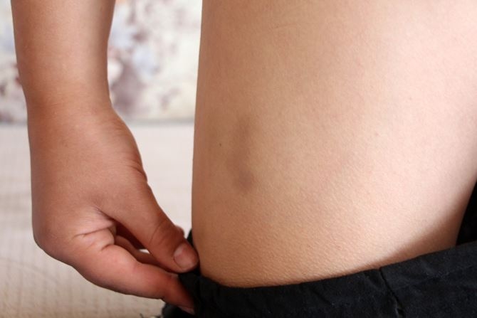 Antalya'da Öğrenci Yurdunda Darp İddiası 2