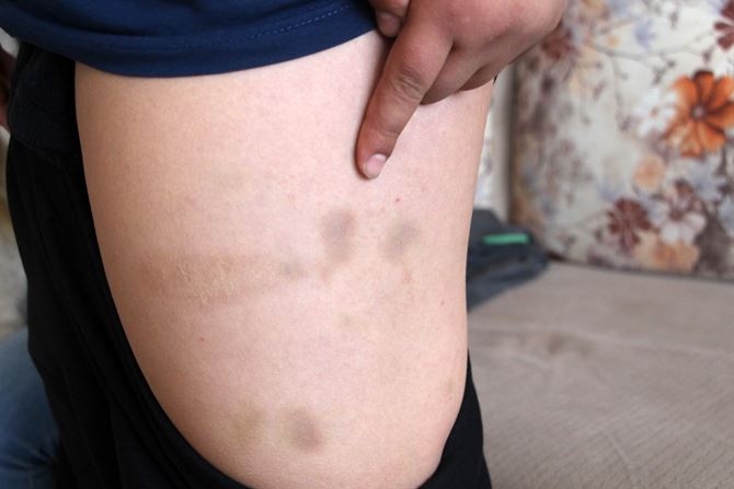 Antalya'da Öğrenci Yurdunda Darp İddiası 4