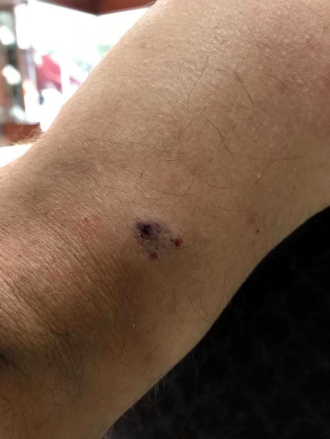 Köpeklerin Saldırdığı 2 Kişi Hastanelik Oldu 4