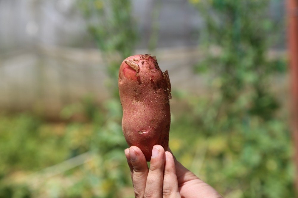 Şeker Hastası Annesi İçin Ekti, İlgiyi Üzerine Çekti 2
