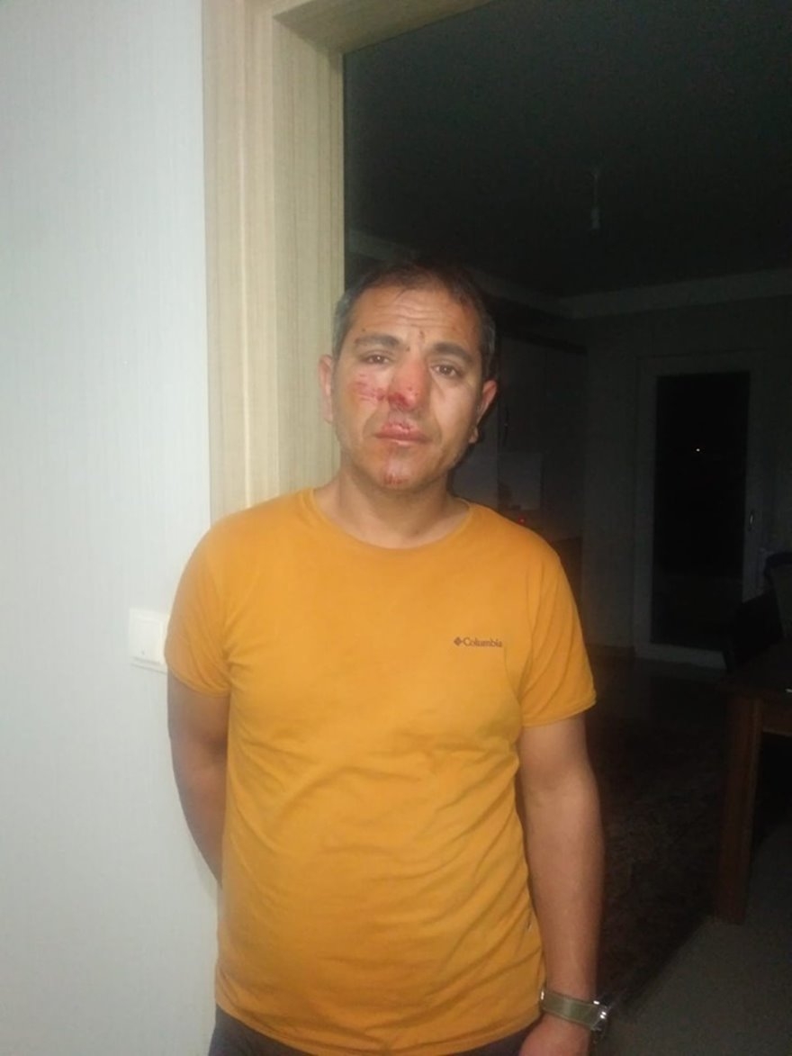 Feci Kaza Sonrası Sinan Koç'un Durumu İyi 4