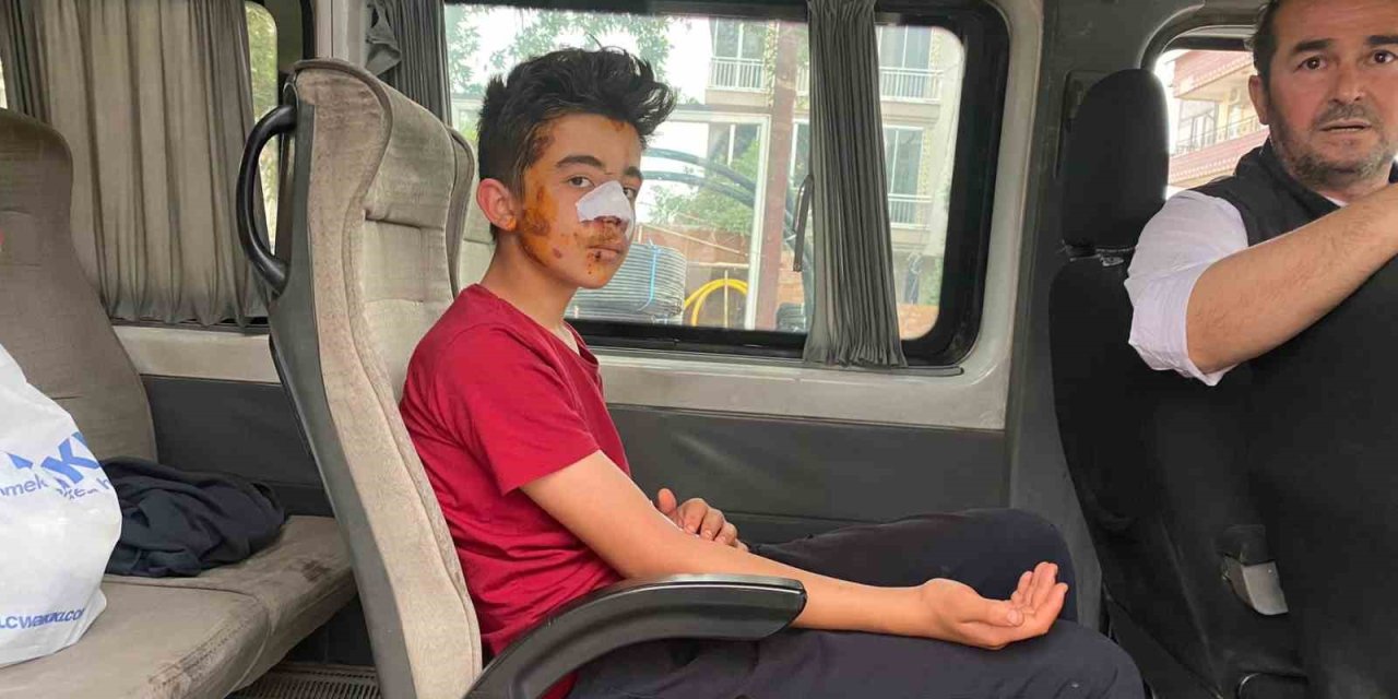 Köpeklerden Kaçarken Otomobilin Çarptığı Genç Canından Oluyordu