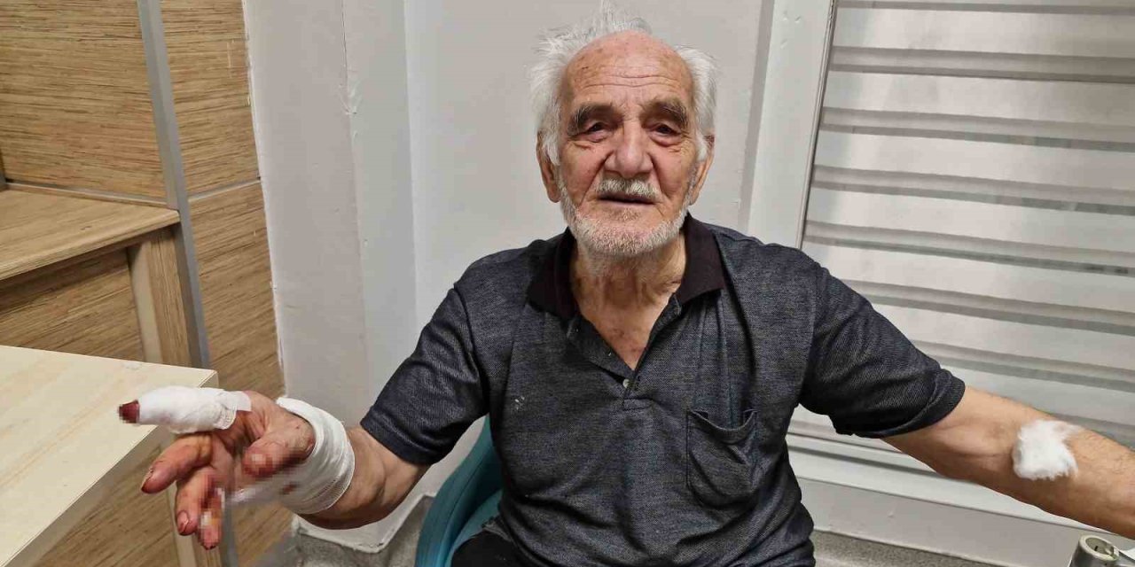 Çoban Köpeği Duvardan Atlayıp Yaşlı Adamın Elini Parçaladı