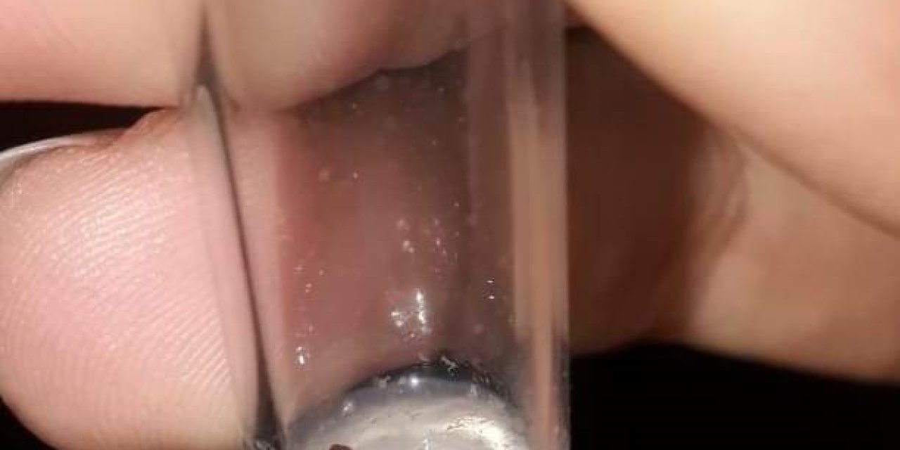 Konya’da Bir Mahallede 3 Kişiye Kene Yapıştı