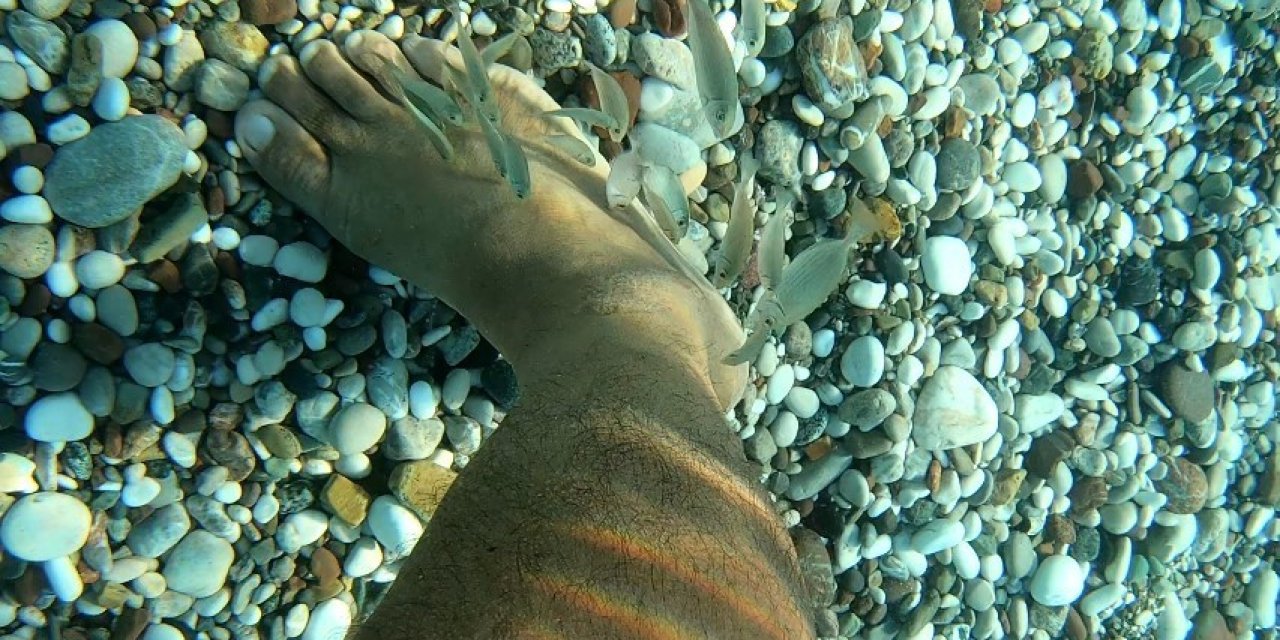 Denize Giren Tatilcilerin Ayaklarındaki Yaraları, Ölmüş Derilere Adeta Saldırıp Tedavi Ediyorlar