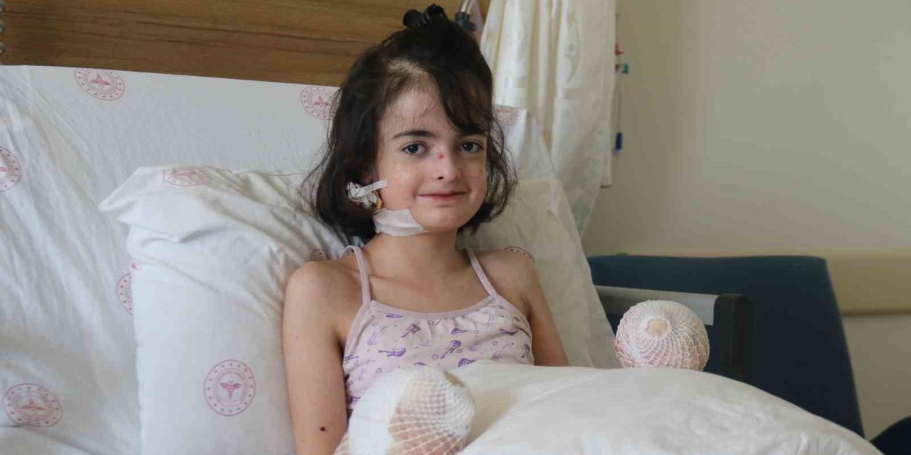 Kelebek Hastası Minik Kız Eskişehir’de Yapılan Ameliyatla Ellerini Kullanabilecek