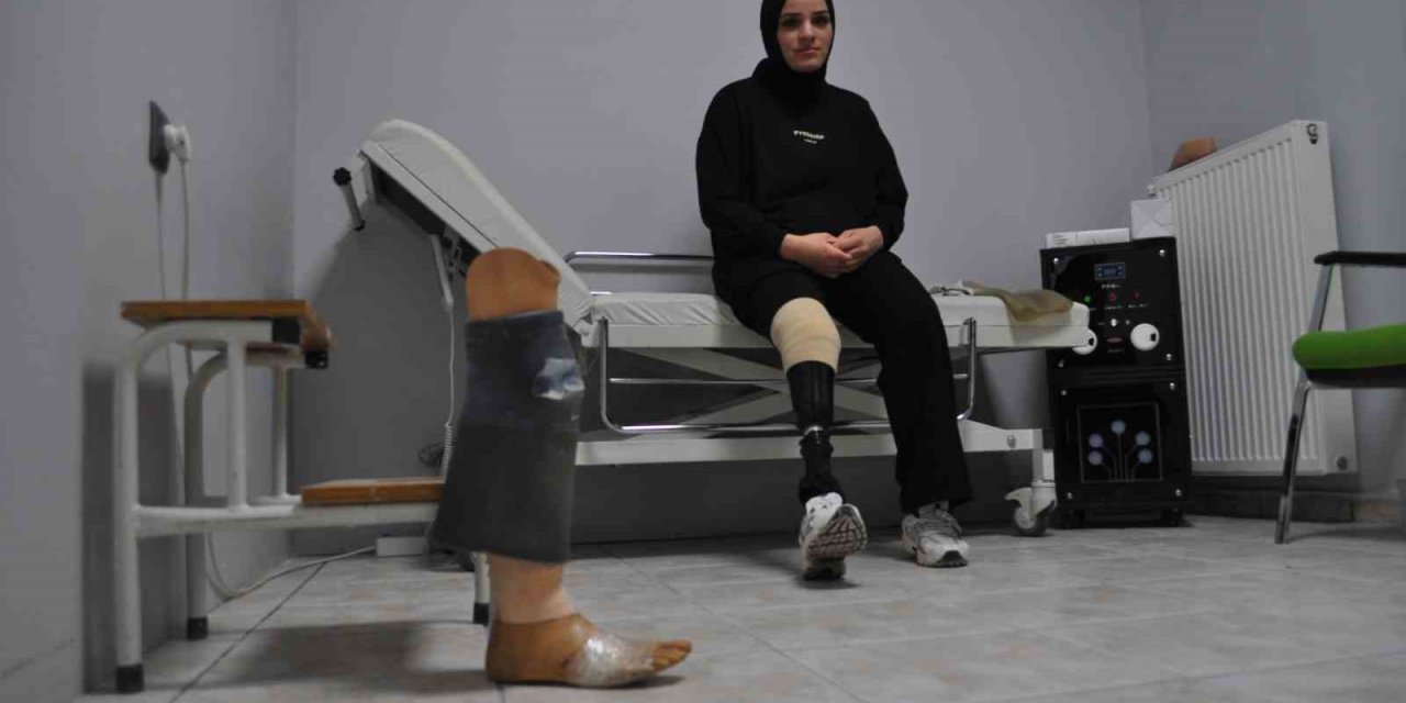 Bantlı Kırık Protezle Çalışıp 4 Çocuğuna Bakan Fedakar Anne