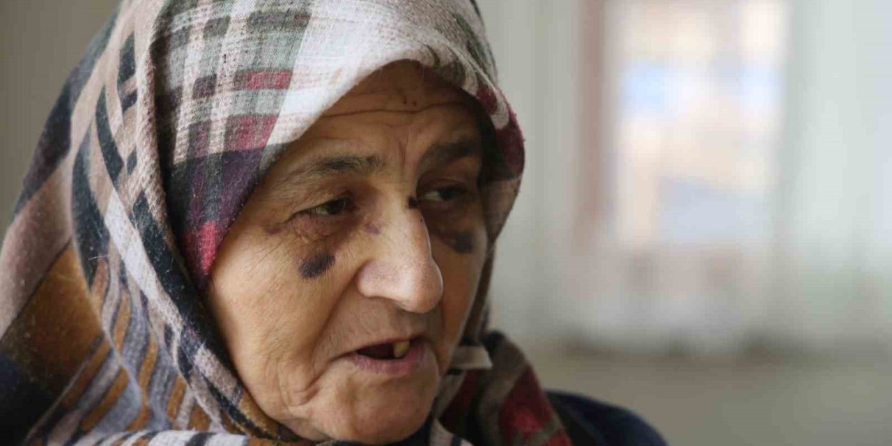 Hem Ters Hem De Geri Geri Gelip Çarptığı Yaşlı Kadının Hayatını Kararttı