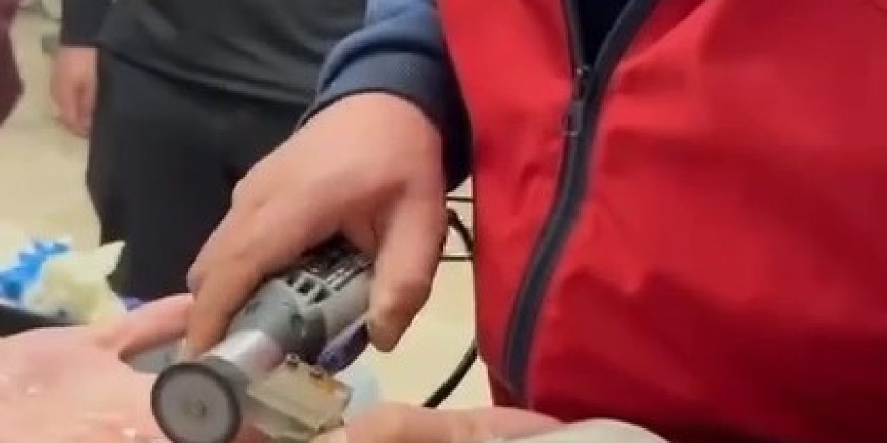 Parmağına Sıkışan Yüzüğü İtfaiye Çıkardı