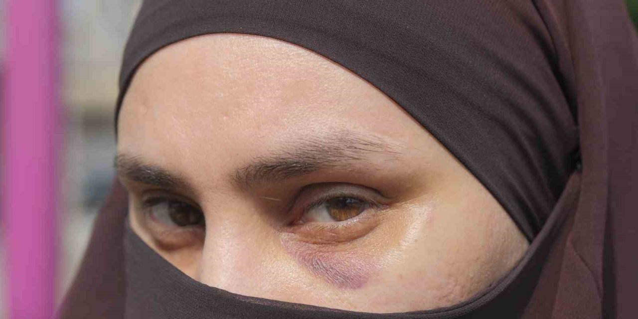 Mersin’de Bir Kadın, Çocuklarının Önünde Darbedildi