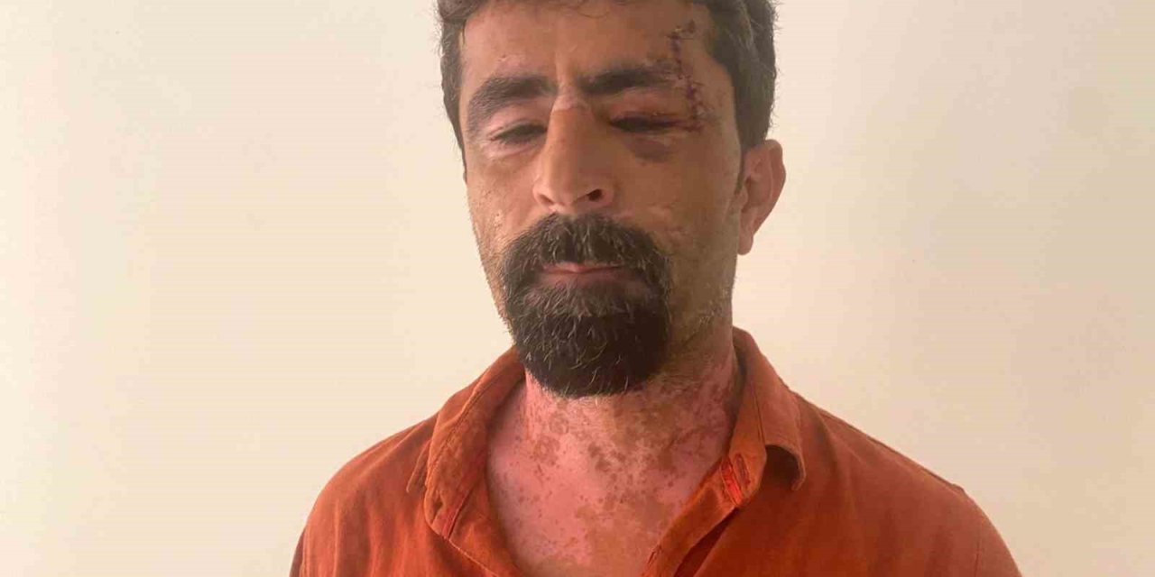 Antalya’da Öfkeli Damat Kayınpederini Hastanelik Etti