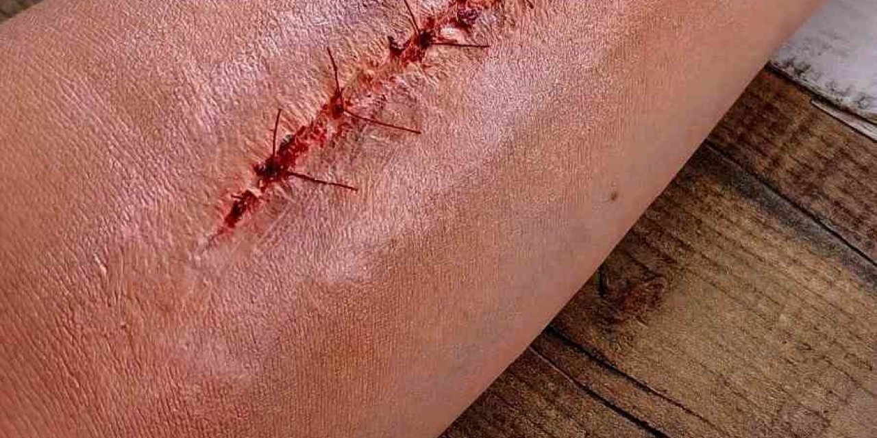 Sihirli Eller Antalya’dan Setlere Uzanıyor