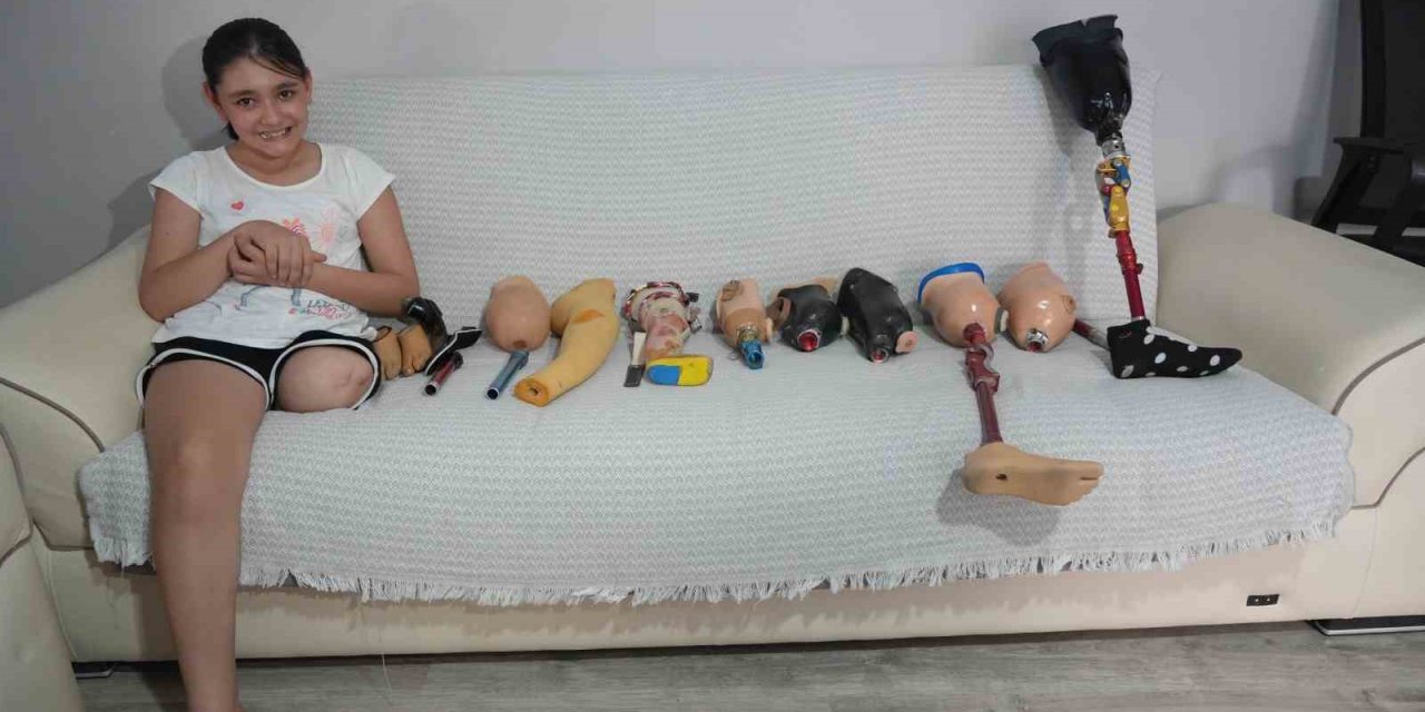 Okulların Açılmasına Günler Kala 12 Yaşındaki Özge’ye Dar Gelen Protez Bacak Engeli