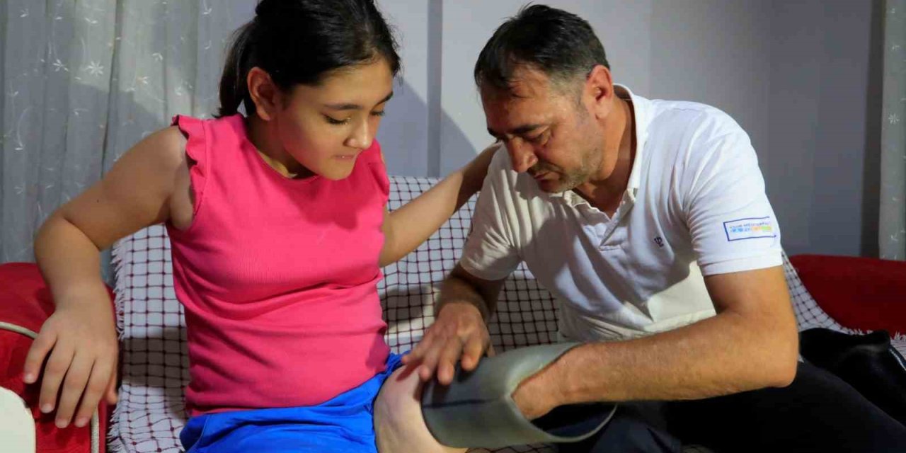 Protez Bacağı Dar Gelen Özge İçin Türkiye Ayağa Kalktı