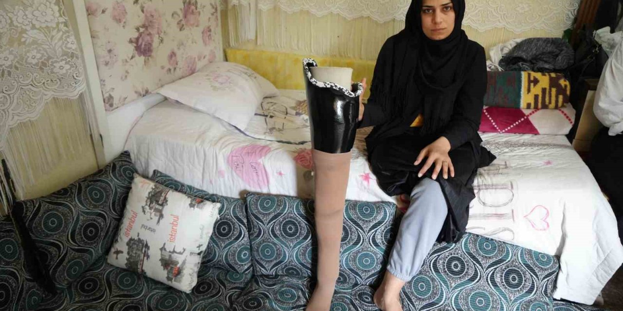 Kahramanmaraş Merkezli Büyük Depremde Bacağını Kaybetti, Eşi Terk Etti