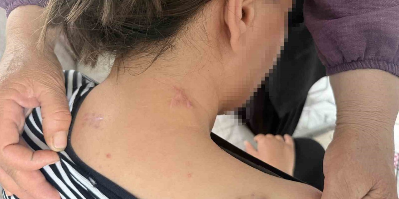 17 Bıçak Darbesi Aldı, Ölü Numarasıyla Kurtuldu, Kocasının En Ağır Cezayı Almasını İstedi