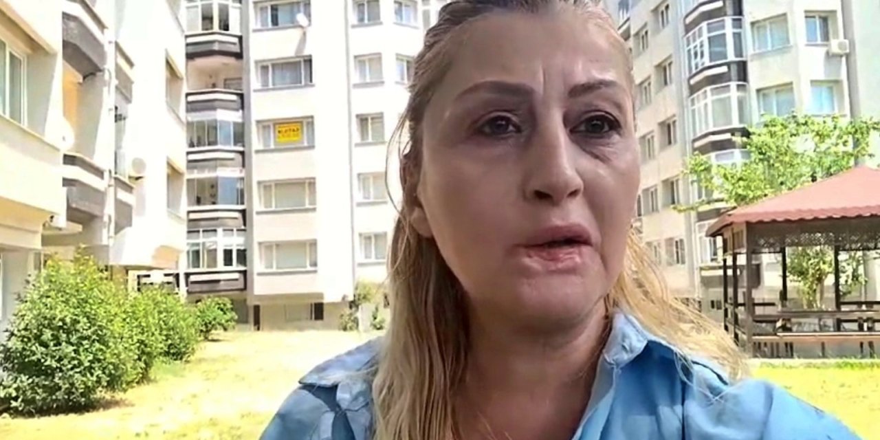 Estetik İşlem Sonrası Dudağı Çürüdü, 7 Yıldır Hukuk Mücadelesi Veriyor
