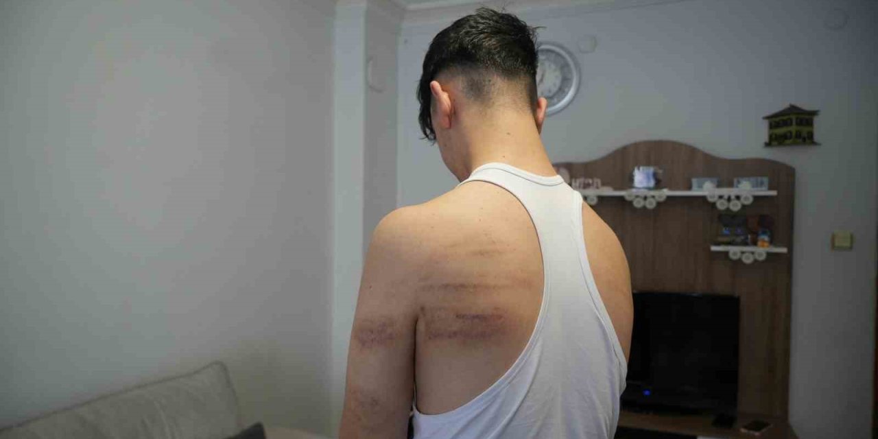 Niğde’de 15 Yaşındaki Berber Çırağına Darp İddiası: Önce Dövdü, Sonra Temizlik Yaptırdı