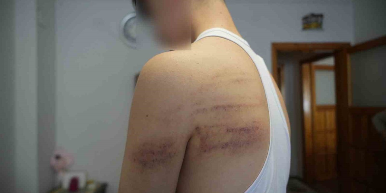 Çırağını Darp Ettiği İddia Edilen Berber Tutuklandı