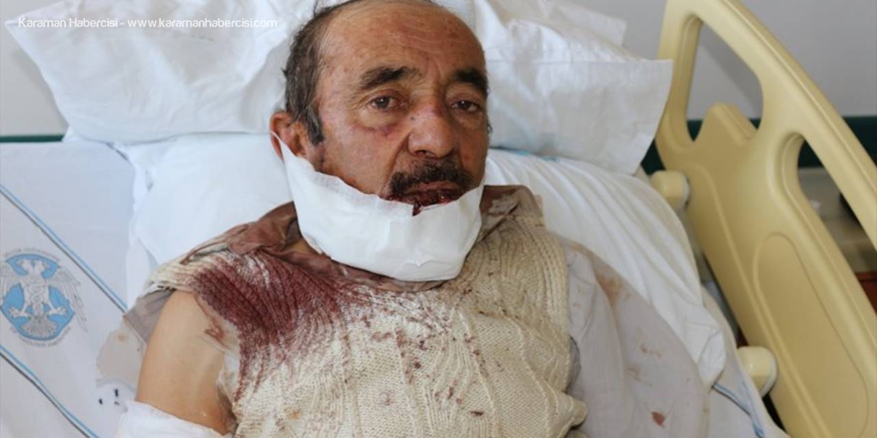 Aksaray'da Köpek Saldırısına Uğrayan Kişi Yaralandı