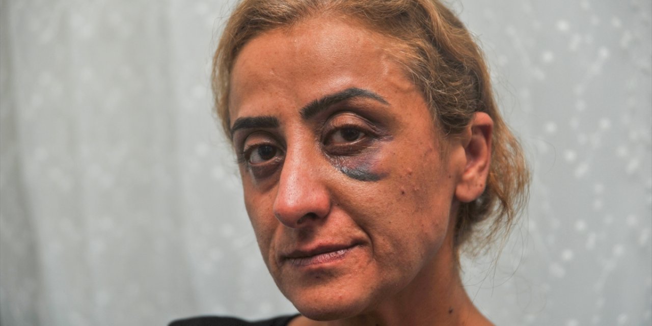 Antalya'da Eski Eşini Darbettiği Öne Sürülen Kişi Hakkında Bir Ay Uzaklaştırma Kararı Verildi