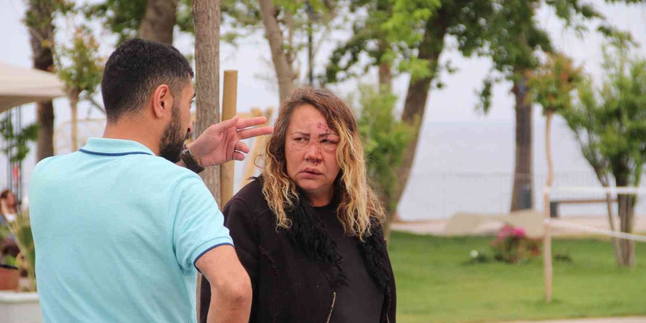 Darp Edilmiş Olarak Yardım İsteyen Rus Kadın Hastaneye Kaldırıldı