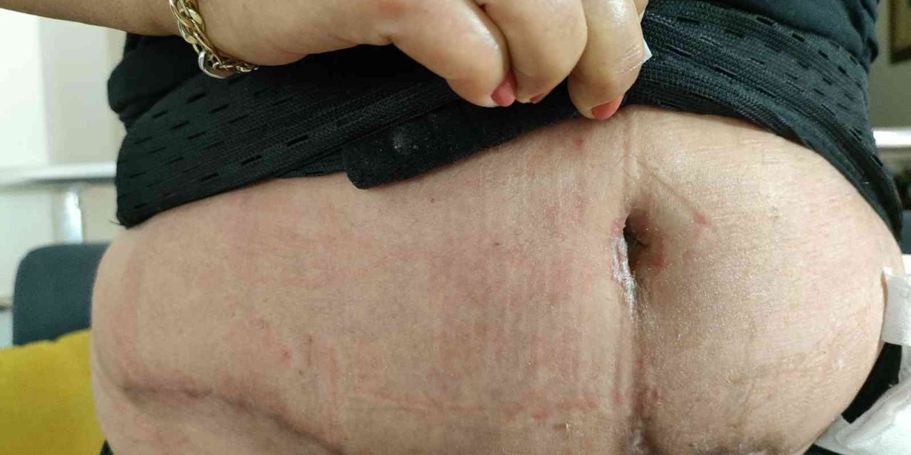 Güzelleşmeye Gitti, Estetik Mağduru Oldu