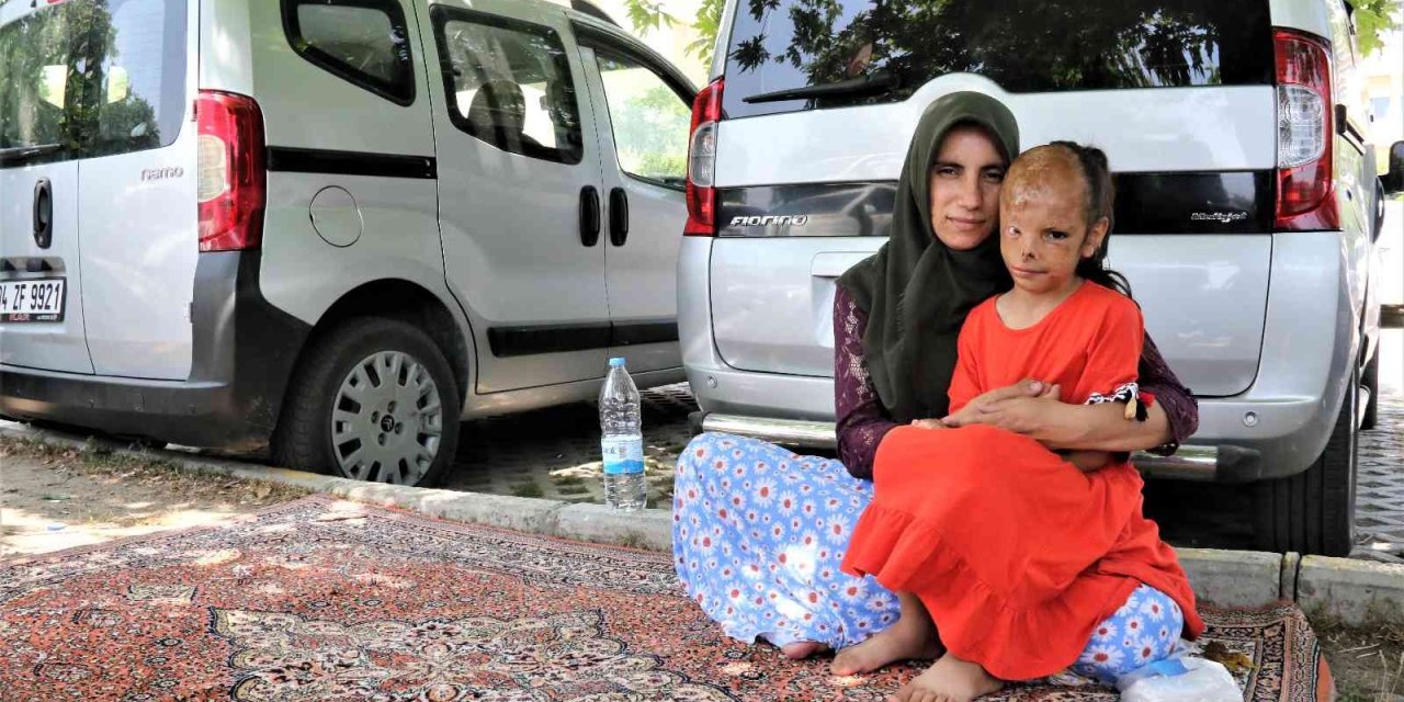 Yangında Yüzü Yanan Dilara’nın Annesi: “allah Razı Olsun Sağlık Bakanlığından, Kızımın Ameliyatını Karşılıyor”