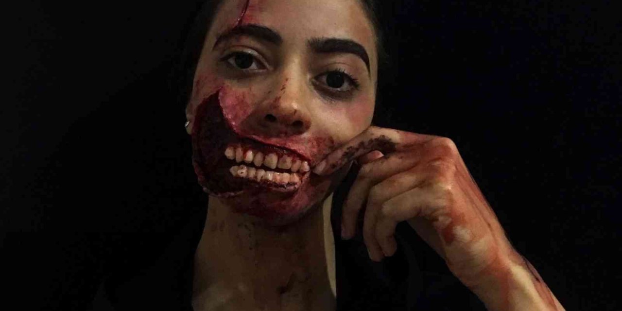 Bu Yaralar Gerçekten Farksız