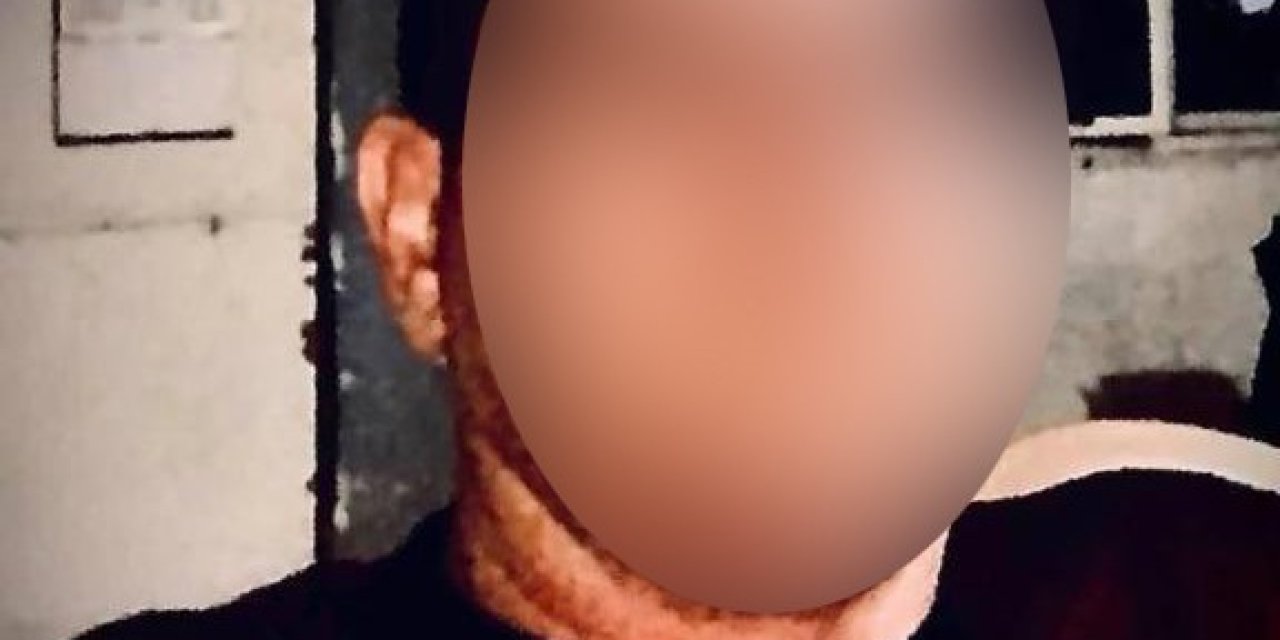 Çalışanı Tarafından Bıçaklanıp Yakılan Patron Hastanede Yaşam Mücadelesi Veriyor