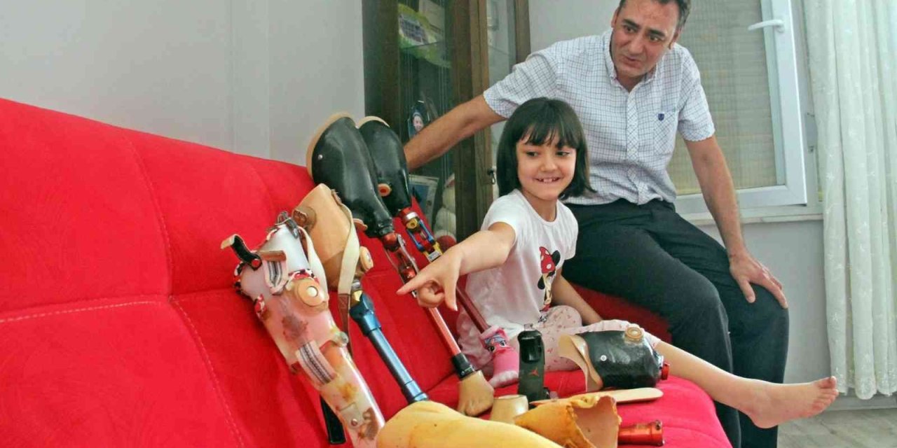 Onun Oyuncakları Protez Bacakları