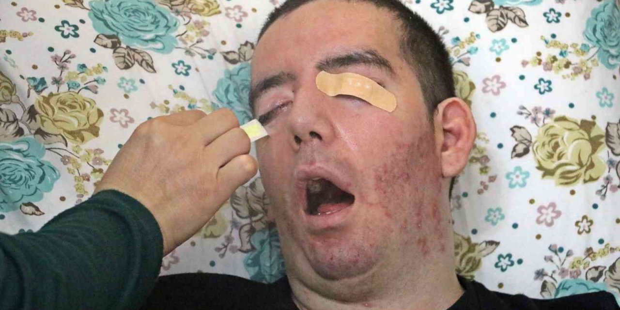 10 Yıldır Gözlerini Bir Kez Bile Kırpamayan Halil, Adeta Kan Ağlıyor