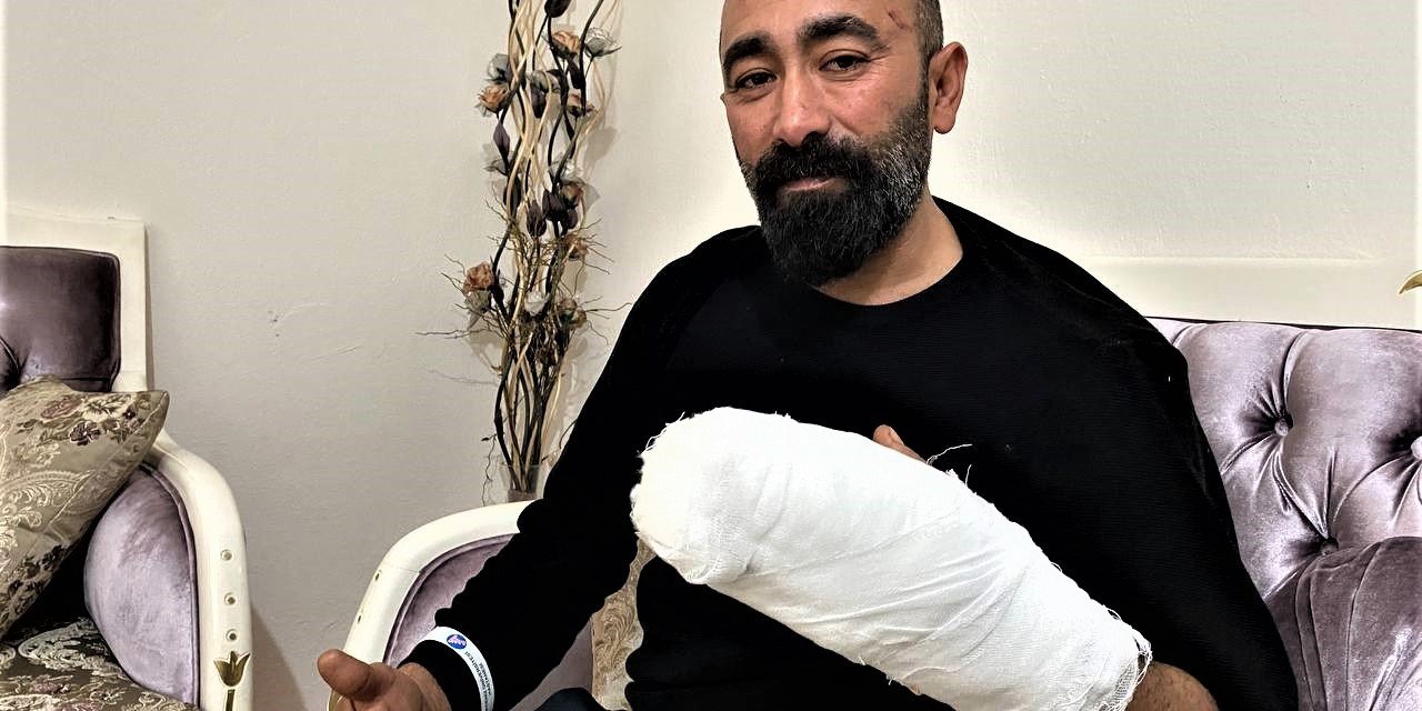 Müşterinin Kaldırım Taşı İle Dehşeti Yaşattığı Taksici: "Kaç Defa Vurdu Sayamadım"