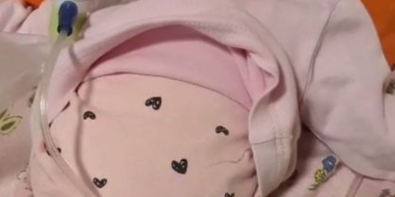 Hastanede Yatan 5 Aylık İkizler Taburcu Oldu