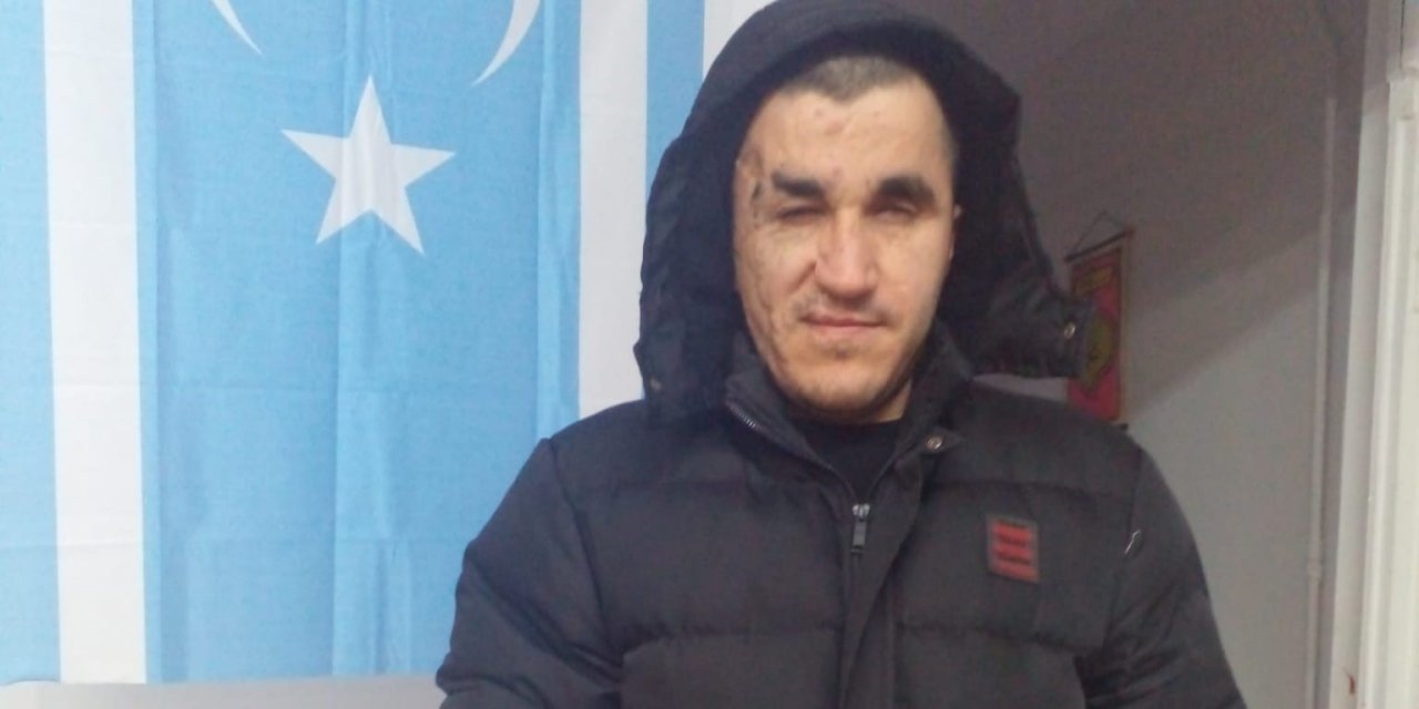 Engelli Gençten Örnek Davranış