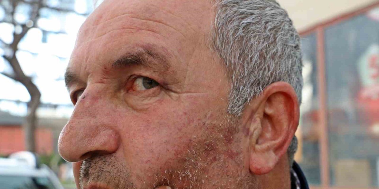 Kulak Zarını Patlatana Kadar Dövdüler, ‘bu Değilmiş’ Deyip Gittiler