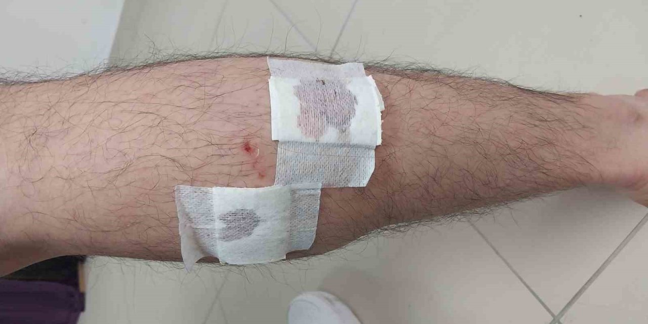 Mersin’de Sokak Köpekleri Belediye Çalışanına Saldırıp Isırdı