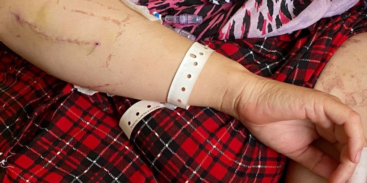 Evin Elektriğini Kesip Kapıyı Açtıran Eşi Tarafından 24 Yerinden Bıçaklandığı Anları Gözyaşları İçinde Anlattı