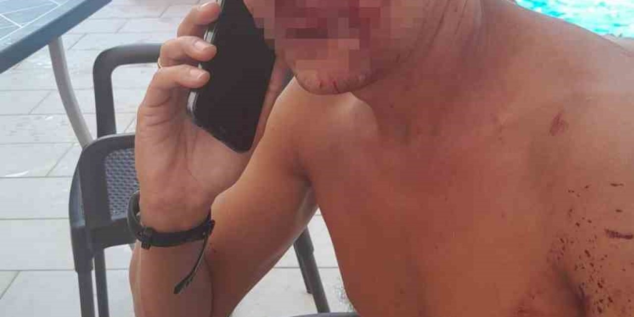 Alanya’da Yaşayan Rus’u Site Yöneticisinin Darp Ettiği İddiası