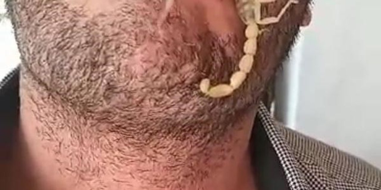 Akreplere Kendini Sokturdu, ‘hayvan Sevgisi’ Dedi