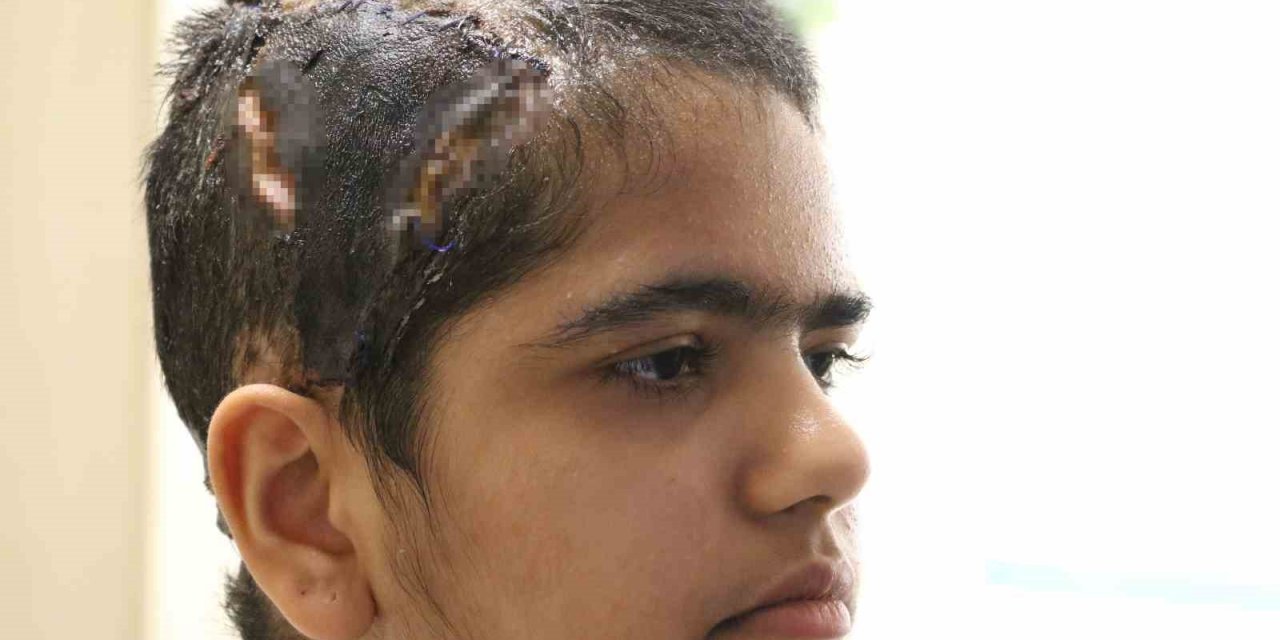 Eğlenmek İçin Bindiği Go-kart’ta Saçı Tekere Dolanan Genç Kız Canından Oluyordu