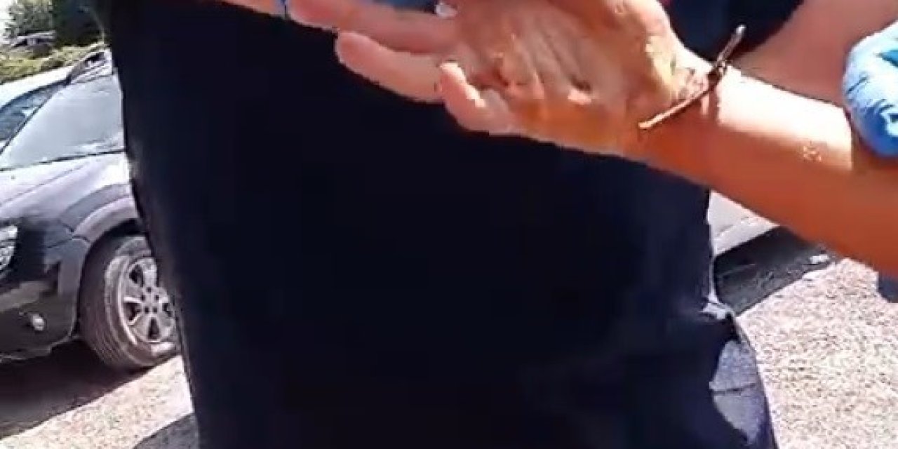 Bileğine Metal Tel Saplandı