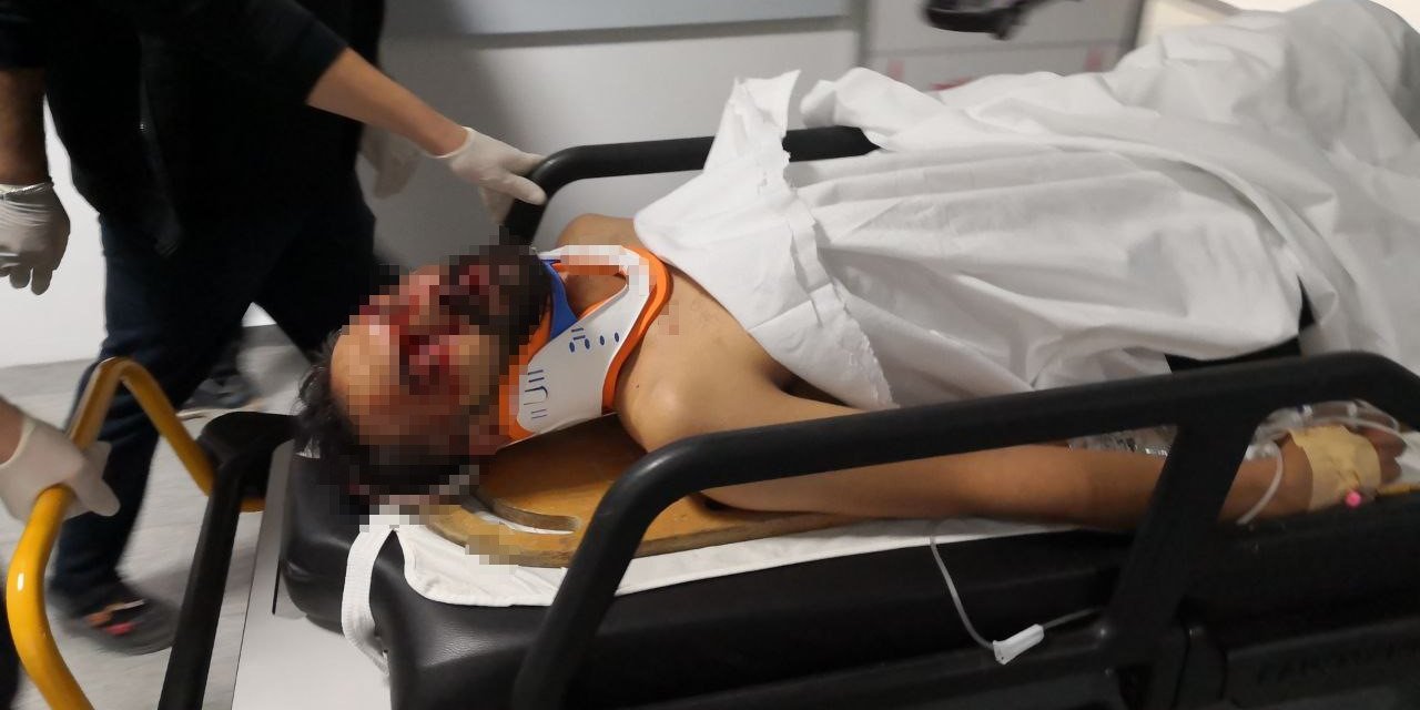 Pencereden Kimliği Alırken 2. Kattan Düşüp Yaralandı