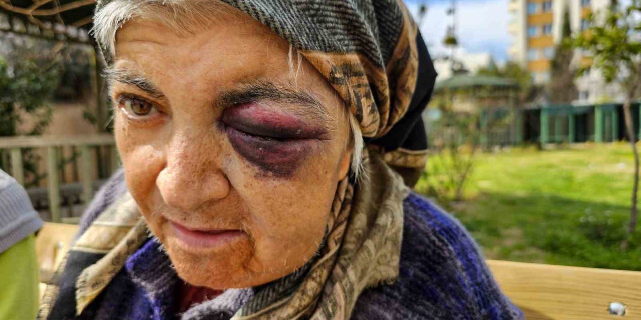 Diyaliz Merkezinde Engelli Kadına Yumruk İddiası