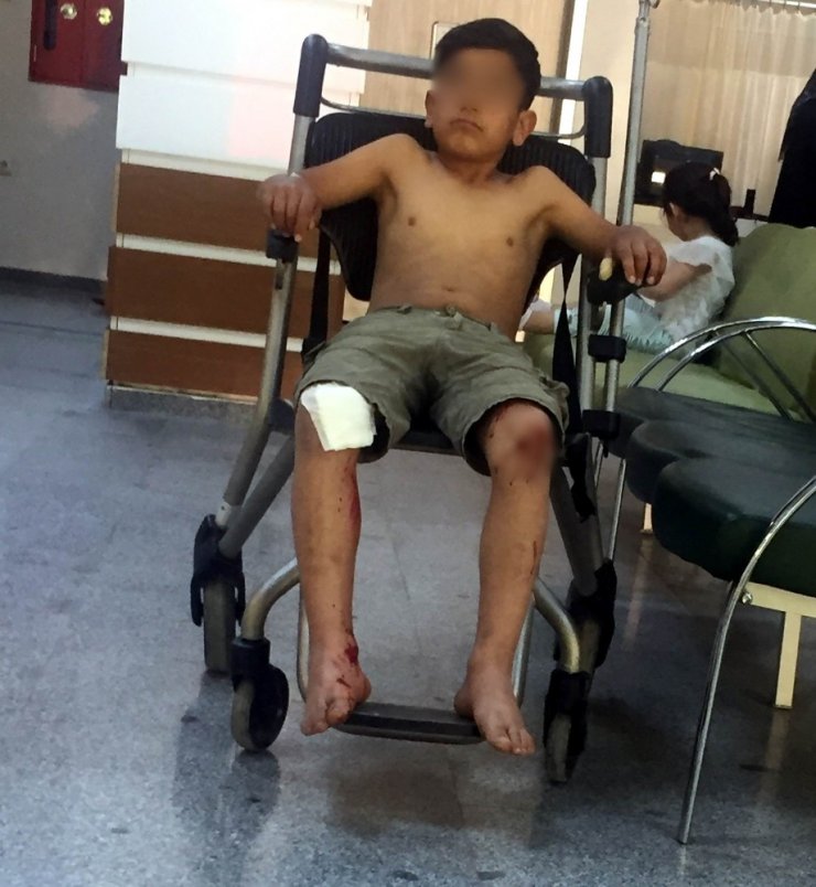 Konya'da Motosikletten Düşen Çocuk Hastanelik Oldu