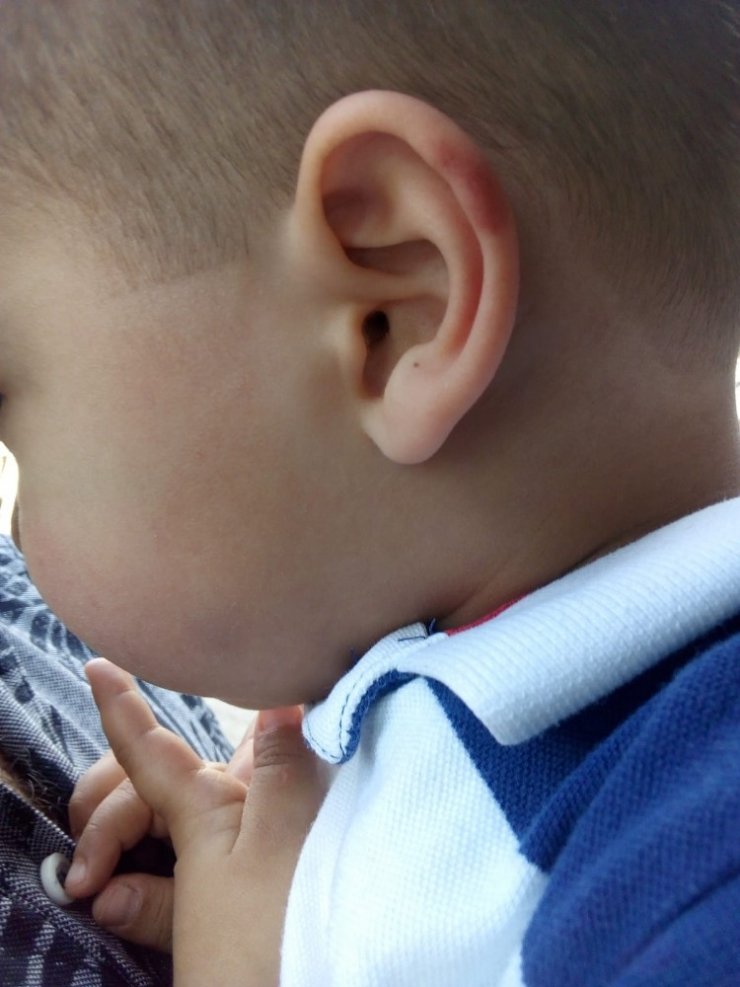 Mersin'de Kreşte 3 Yaşındaki Çocuk Darp Edildi